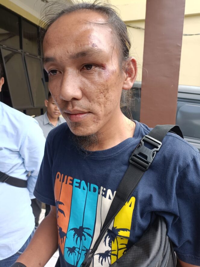
 Ketua SIWO PWI Linggau Babak Belur Dihajar Orang Berseragam Brimob Bersenjata Laras Panjang